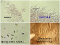 Climacodon pulcherimus-amf1481-3
